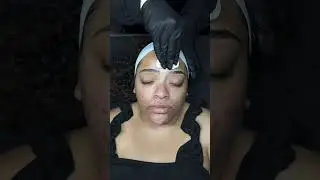 Face Reality Peel at Galore Medical  #skincare #facereality