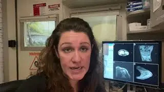 Lead Technician at Med Tech Imaging Center discussion of the Upper Extremity