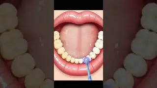 Teeth cleaning! 🪥😁 #teeth #teethhealth #teethcleaning #teethcleaninggame #asrmgame #asrmgamingvedio