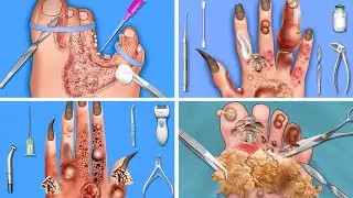 Foot Surgery Doctor Care ASMR | Game Trailer | Aesthetic Gaming Labs