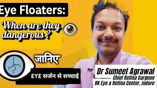 Eye Floaters: कब होता है रेटिना डेंजर? जानिए डॉक्टर से सच्चाई 👁️🚨