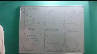 PFT /Spirometry interpretation/common pattern/spirometry graphs