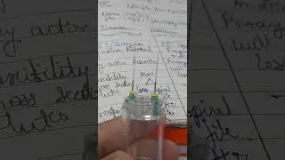 K file vs reamer difference real ones| Endodontics| Root canal treatment or therapy