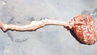 الاصابة بفطر الاسبرجلس (Aspergillus Fumigatus ) الوقاية والعلاج