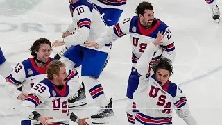 2026 winter olympics | jack hughes | jack hughes hockey | jack hughes teeth 