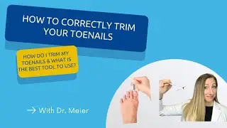 How to correctly trim your toenails