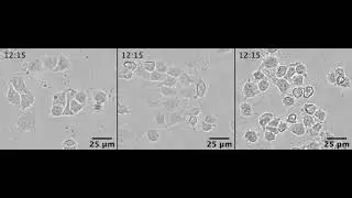 Benzophenones with Antiausterity Activities against the PANC-1 Human Pancreatic Cancer Cell Line