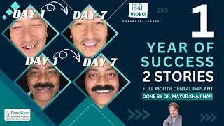 Full Mouth Dental Implants & Reconstruction in Mumbai - Dr Mayur Khairnar