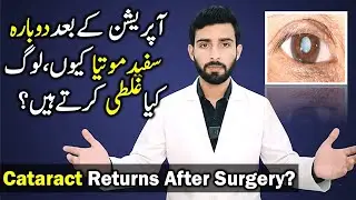 Why Vision Becomes Cloudy After Cataract Surgery|Motiya Ke Baad Nazar Dhundli Kyun