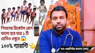 রিকেটস রোগের চিকিৎসা | রিকেটস রোগের হোমিও ওষুধ | Rickets Treatment | Dr. Waliur Rahman Shuvo