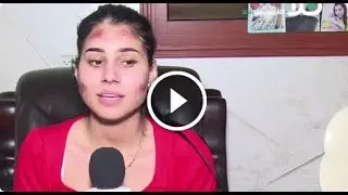 سوسن عمر تتحدث عن ظهور اعراض عليها بعد تلقيها الجرعة الثانية من اللقاح