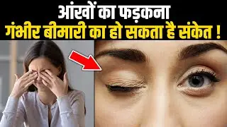 अगर बार बार फड़कती हैं आपकी आंखें, तो हो जाएं सावधान ! जानिए क्यों ?