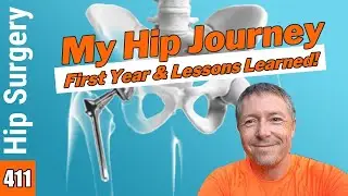 Total Hip Replacement monthly progress and LESSONS LEARNED