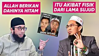 Dahi Hitam Tidak Selalu Jadi Pertanda Benar Sujudnya - Ustadz Adi Hidayat