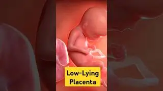 Low-Lying Placenta Explained | Causes, Precautions & Tips | Dr.Roopa Ghanta | Little Stars & She
