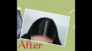 Sebornil Shampoo @VladandNiki @allmedicaltipsandhelps1616 @imrankhanworld