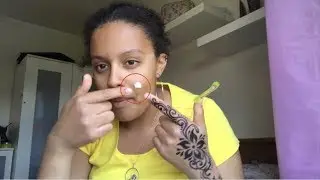 WEIRD ACNE LIFE HACKS EVERYONE SHOULD KNOW!