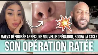 MAEVA MOQU&Eacute;E PAR BOOBA APR&Egrave;S SON OP&Eacute;RATION RAT&Eacute;E, ELLE R&Eacute;AGIT 😱 