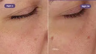 NEW! Novexpert Pro-Retinol Dual Booster Serum