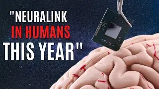 NEURALINK UPDATE: Human Trial Impants To Happen This Year