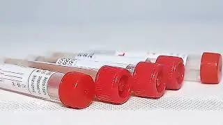 Babio VTM Virus Transport Media（ inactivated）