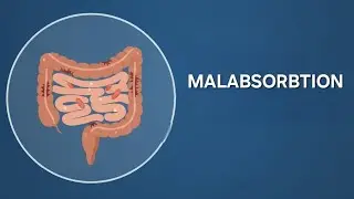 سو جذب | Malabsorption