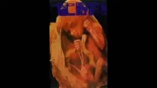 Tympanic Membrane - The End Of Tragical Episode Roentgenologisty (1996)