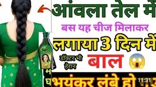 Dabur Amla oil, Make your Hair Black , thick, strong and long overnight in just 10 rupees😃3 दिन में