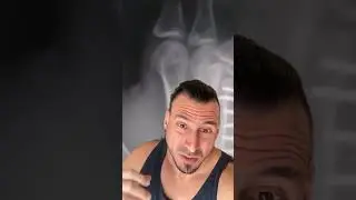 Cuida los NUDILLOS!