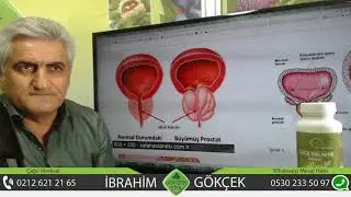 Prostat Nedir?, Prostat Hastalığı Tedavisi, Prostat B&uuml;y&uuml;mesine Doğal &Ccedil;&ouml;z&uuml;m,
