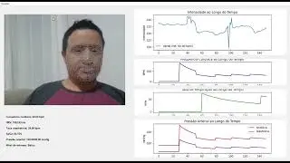 Monitor de Sa&uacute;de por Fotopletismografia - Um M&eacute;todo N&atilde;o-Invasivo para Avalia&ccedil;&atilde;o de Sinais Vitais
