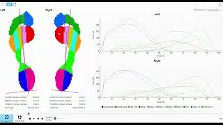 Footscan assessment of presentation with stiff low back and pelvis