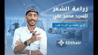 رحلة عملية زراعة الشعر في تركيا🇹🇷 للسيد محمد علي | عملية زراعة الشعر 💯% بدون ألم ❌