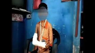 Teacher beats student in Surat urdu school, fracture in hand