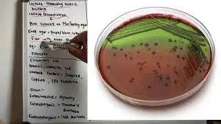 Lactose fermenting enteric bacteria| E. Coli | Klebsiella | -18