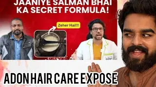 बालों का झड़ना रोकें: Adon Hair Care के साथ और Hair Mix मिथकों का पर्दाफाश | मेरी प्रतिक्रिया