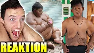 Der dickste Junge der Welt hat krass abgenommen! | Sascha Huber