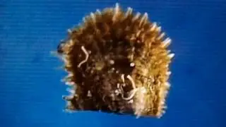 Watch An Akoya Pearl Oyster Grow