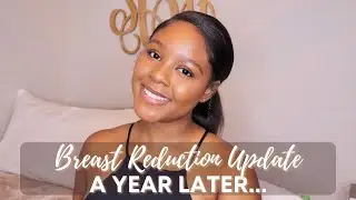 QUICK 1 YEAR BREAST REDUCTION UPDATE + CHIT CHAT!!