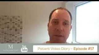 FUT Hair Transplant Results – 4 Months After Surgery – Video Diary #17