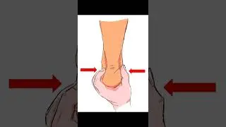 Calcaneal Squeeze Test | Sever&rsquo;s Disease vs Calcaneal Stress Fracture Explained #meded #anklepain