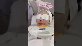 SPL Laser treatment at The Cosmo Clinic in Bangkok
