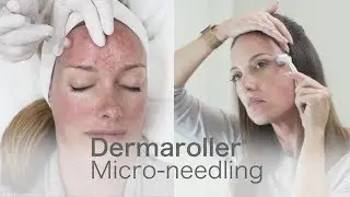 DermarollerClinics com - eDermaStamp&reg; and the Home Care product line by Dermaroller&reg;