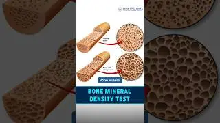 DEXA Scan: More Than Just Bone Health! | Dr Ankush Govindwar