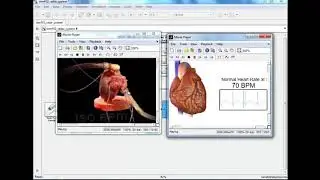 Ultra Low Power Heterogeneous Bio Signal Analysis Matlab Projects