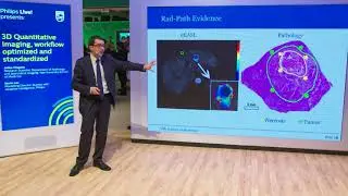3D Quantitative Imaging, workflow optimized and standardized