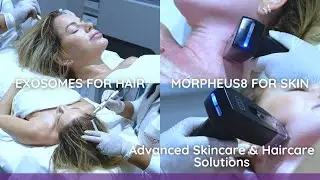Morpheus8 and Exosomes treatment exclusively at Cocoona Clinic, Dubai