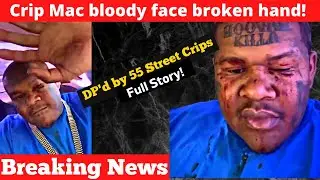 Crip Mac explains why he got bloody face, broken hand from 55th Street Crip DP.