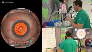 How to Use EYESI Simulator the Smart Way: Strategic Training for Maximum Surgical Improvement.