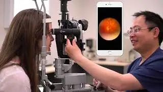 oDocs nun Ophthalmoscope in action